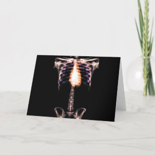 ORIGINAL X-RAY SKELETON TORSO RIBS CARD