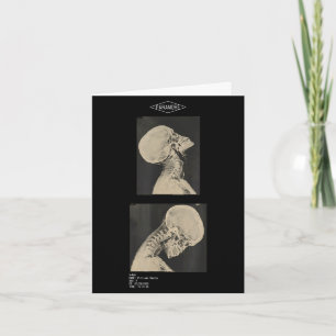 Paramore cropped headbanger x-ray doctors  card