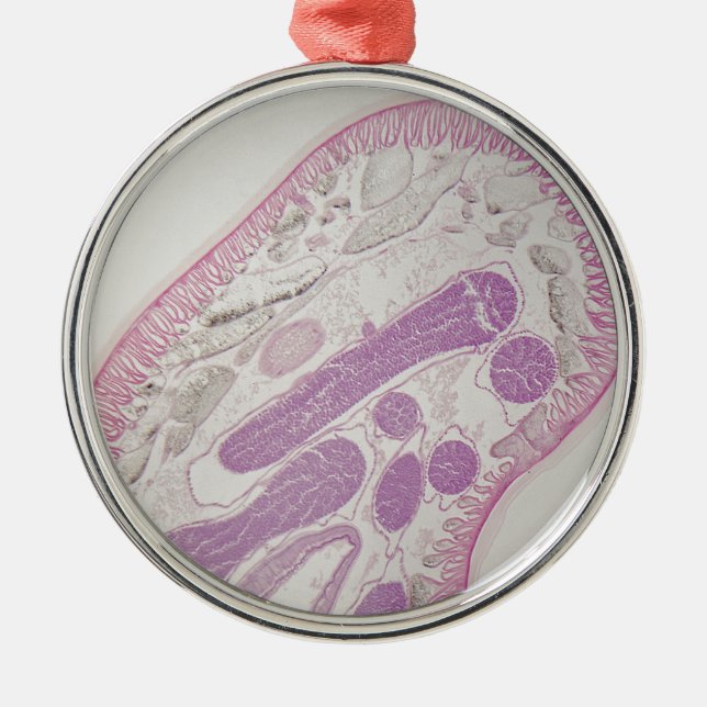 Parasitic nematode worm (Ascaris sp.) Metal Tree Decoration (Front)