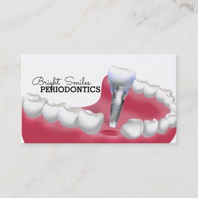 Periodontist Dentist Business Card (Front)