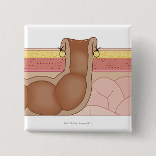 Permanent Colostomy 15 Cm Square Badge