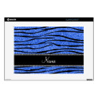 Personalise name blue glitter zebra stripes