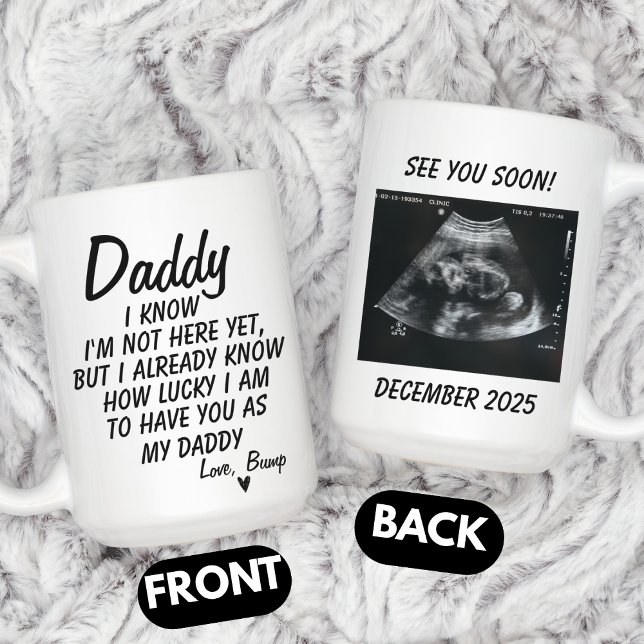 Personalised Sonogram Photo, Ultrasound Photo Baby Coffee Mug (Creator Uploaded)