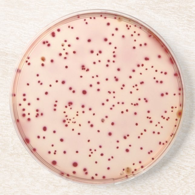 Petri dish coaster (Front)