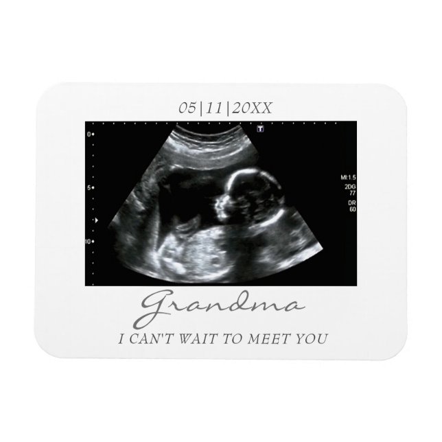 Photo Magnet Ultrasound Gifts for Grandma Sonogram (Horizontal)