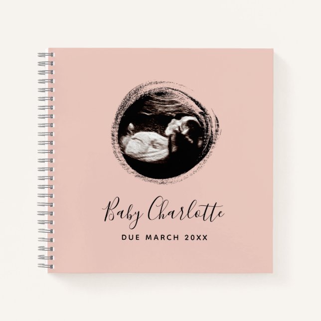 Pink Baby Girl Sonogram Ultrasound Pregnancy Book (Front)