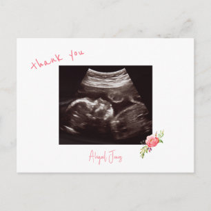 Pink Baby Shower Ultrasound Cute Font Thank You Postcard