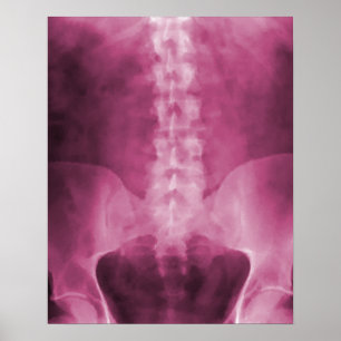 Pink Digital X-Ray Art Print