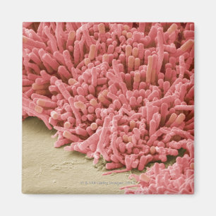 Plaque-forming bacteria, coloured scanning magnet