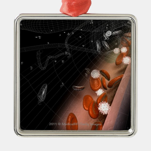 Plaque in the arteries metal tree decoration (Front)