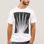 Polydactyly, Six Fingered Hand, X-Ray, rarity! T-Shirt<br><div class="desc">Six Fingered Hand This X-ray, stripped of identifying marks, is presented by Drgnu23, a Podiatrist that works with the underprivileged. Presented here is a medical rarity--the hand of a ten year old boy born with six fingers. Presented on a black tee-shirt, this image will leave people curious and mystified with...</div>