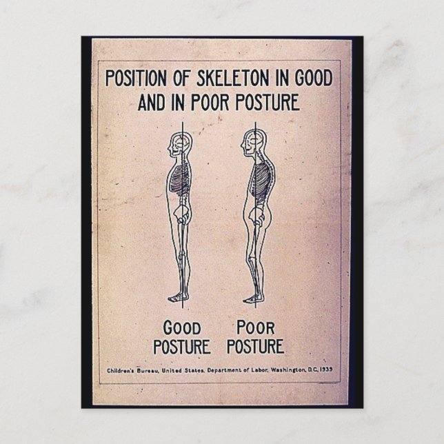 Position Of Skeleton In Good And In Poor Posture Postcard (Front)