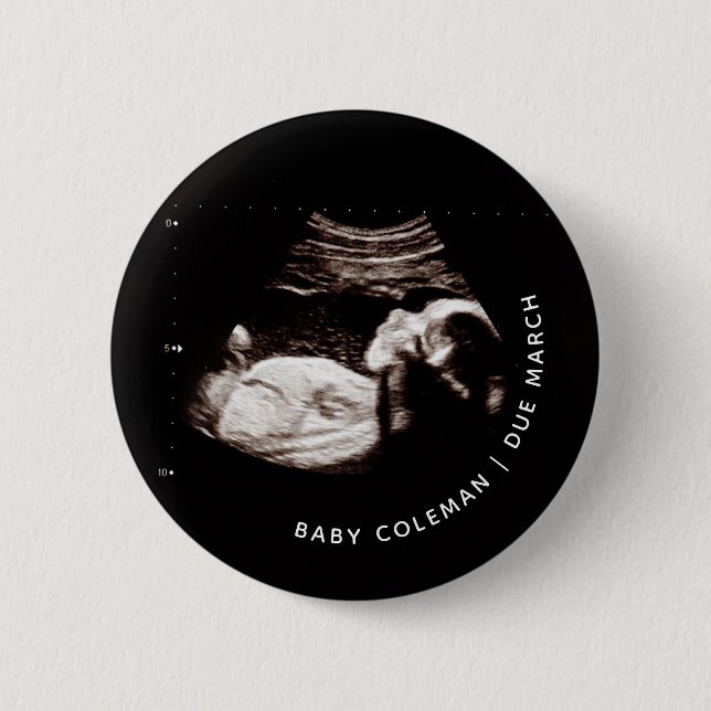 Pregnancy Announcement Baby Sonogram Photo 6 Cm Round Badge (Front)