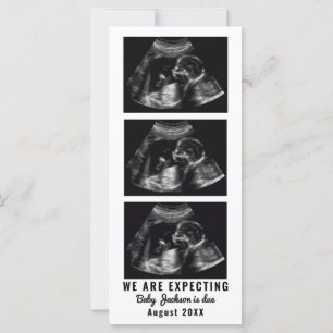 Pregnancy Announcement Card With Ultradound Photos
