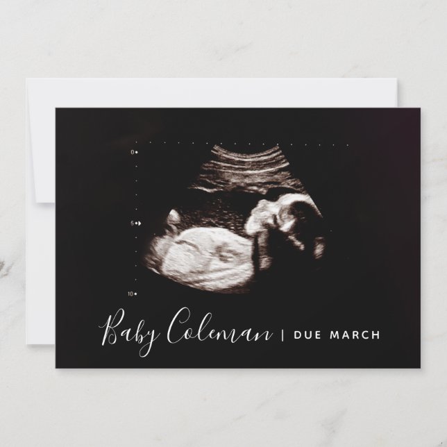Pregnancy Announcement Sonogram Script Name Card (Front)