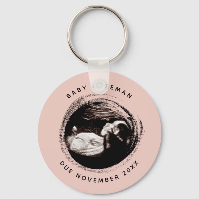 Pregnancy Baby Girl Sonogram Ultrasound Photo Pink Key Ring (Front)