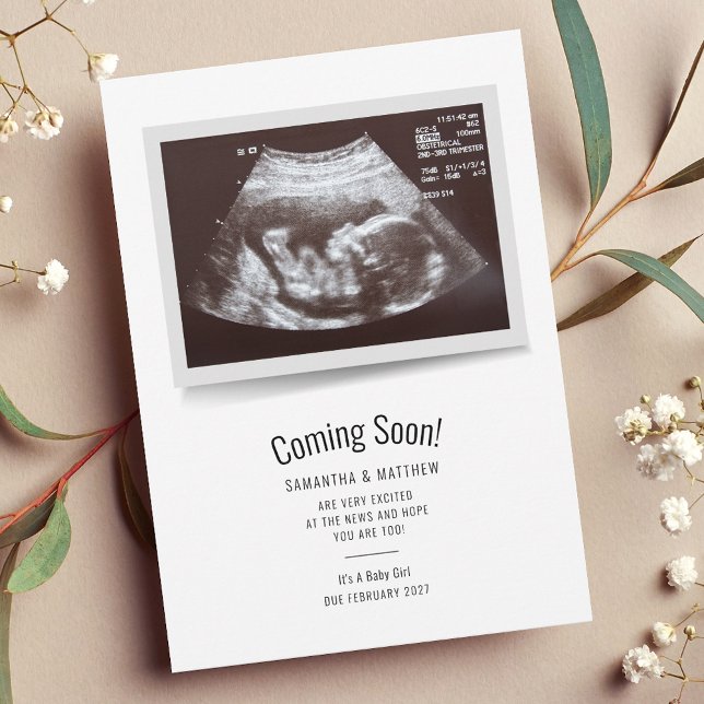 Pregnancy Scan Sonogram Baby Announcement (Pregnancy Announcement Sonogram Scan Card)