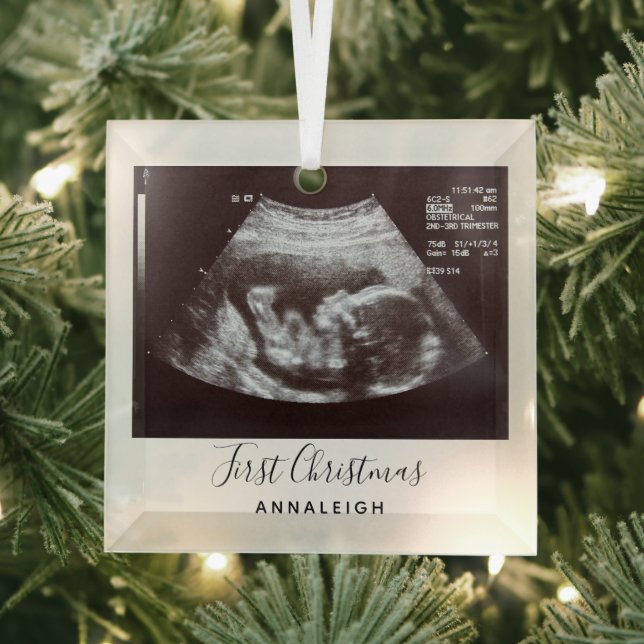 Pregnancy Ultrasound Photo First Christmas Holiday Glass Tree Decoration (Insitu)