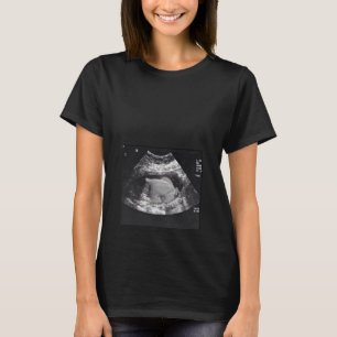 PREGNANT TURKEY ULTRASOUND T-Shirt