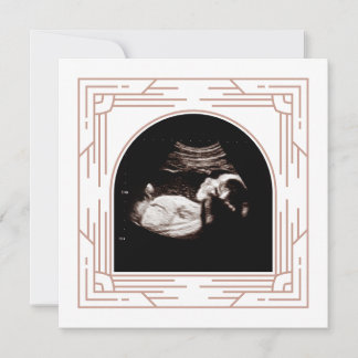Pretty Pink Frame Baby Sonogram Photo  Announcement