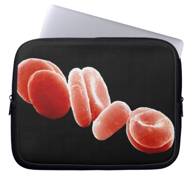 Red Blood Cells Laptop Sleeve (Front)
