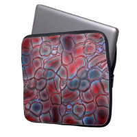 Red cell tissue with soft light flare or inflated