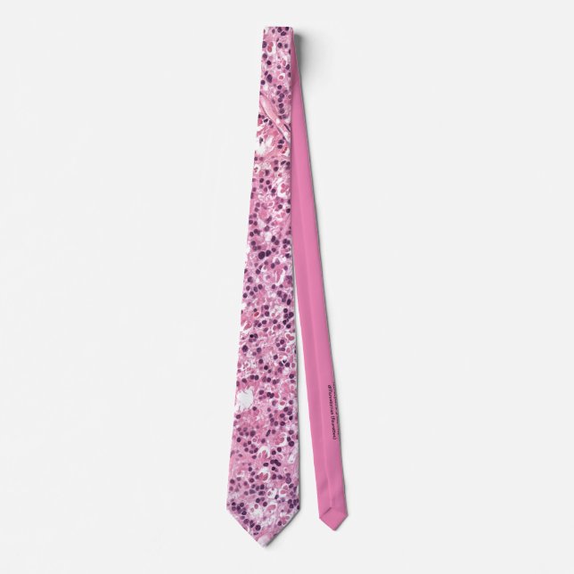 Retinocytoma: Fleurettes Tie (Front)