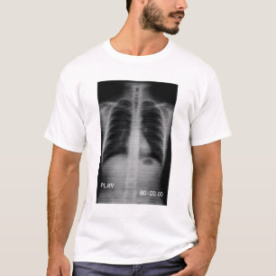 “Retro VHS X-Ray” Old-school chest X-ray with VHS  T-Shirt