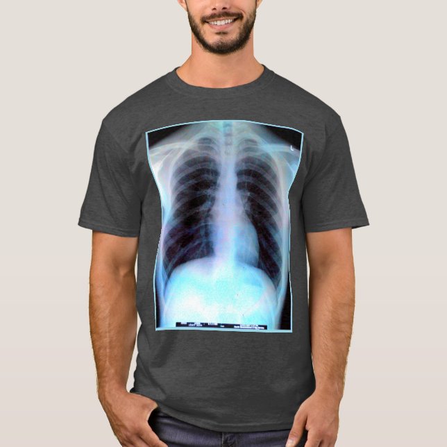 Ribcage X-ray Shirt (Front)