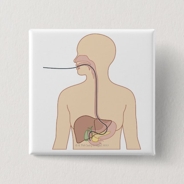 Route of Endoscope 15 Cm Square Badge (Front)