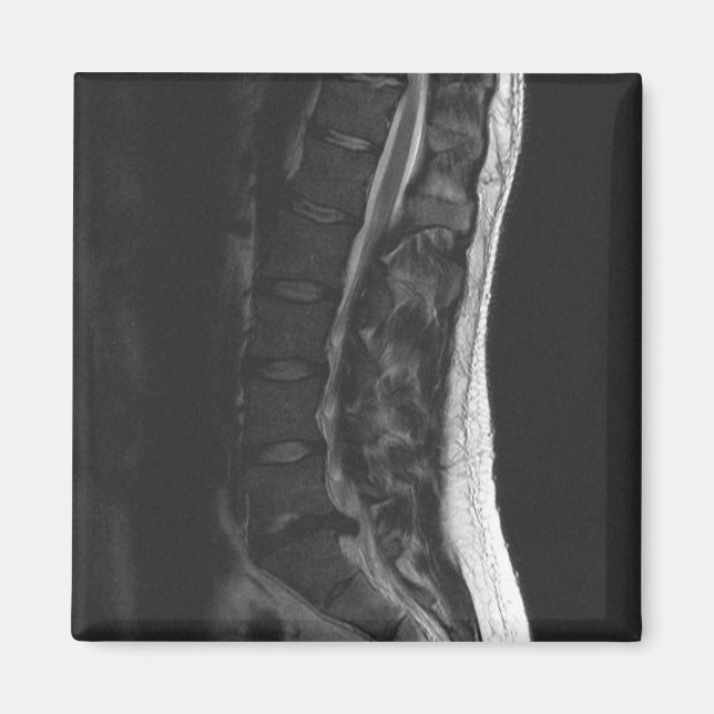 Ruptured Disc Magnet (Front)