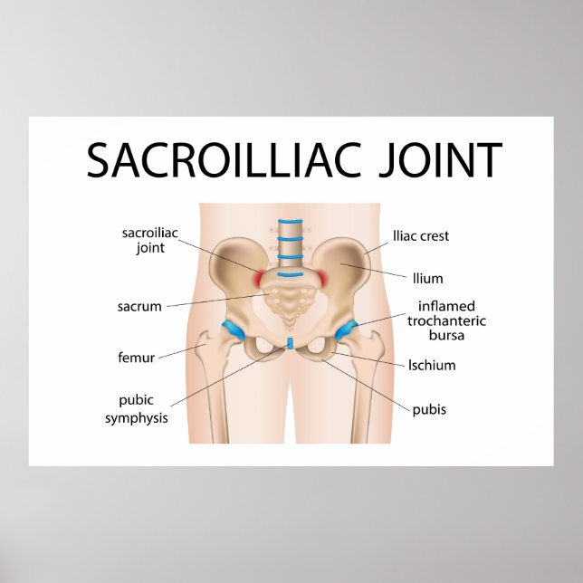 Sacroilliac joint poster (Front)
