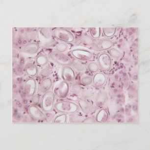 Science Parasite Postcard