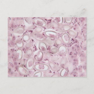Science Parasite Postcard