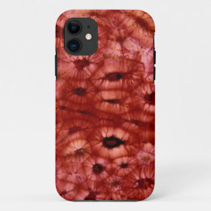 Sclerenchyma Cells from a Cherry Pit Case-Mate iPhone Case