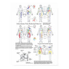 Sclerotome Visceral Pain Referral Chart
