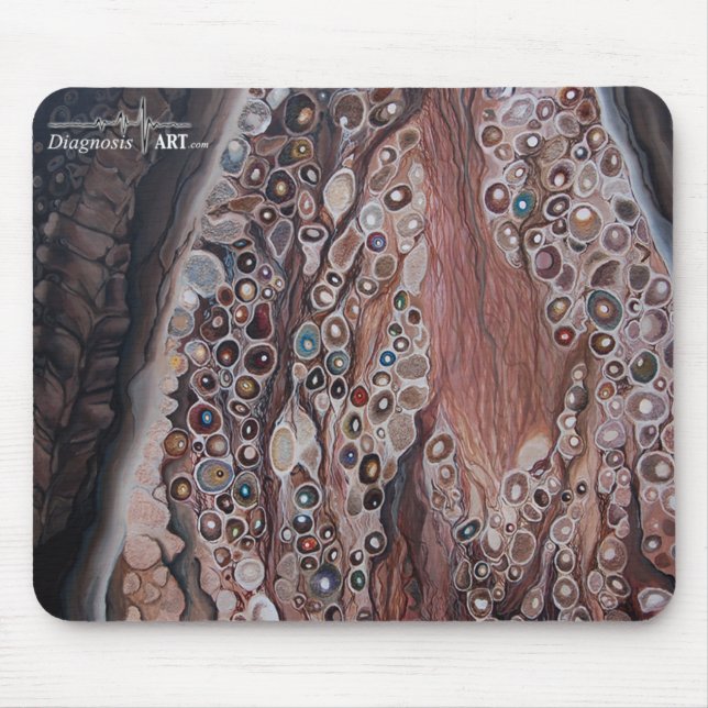 "Sensation: Dorsal Root Ganglion" Mouse Pad (Front)