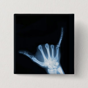 Shaka Sign X-Ray (Hang Loose) 15 Cm Square Badge