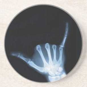 Shaka Sign X-Ray (Hang Loose) Coaster
