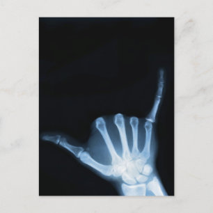 Shaka Sign X-Ray (Hang Loose) Postcard