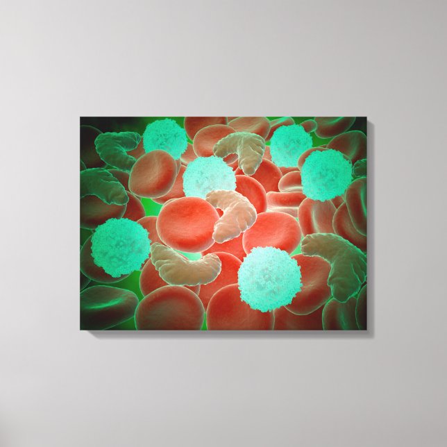 Sickle Cell Anaemia With Red Blood Cells Canvas Print (Front)