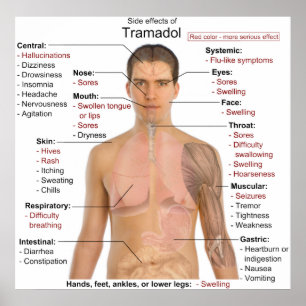 Side Effects Chart for Tramadol Hydrochloride