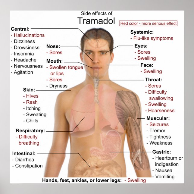 Side Effects Chart for Tramadol Hydrochloride (Front)