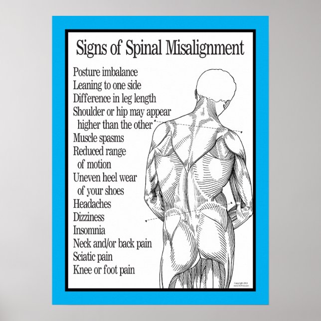 Signs of Spinal Misalignment Chiropractic Poster (Front)