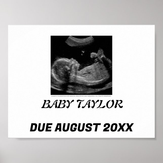 SIMPLE& SWEET: BABY ANNOUNCEMENT POSTER (Front)