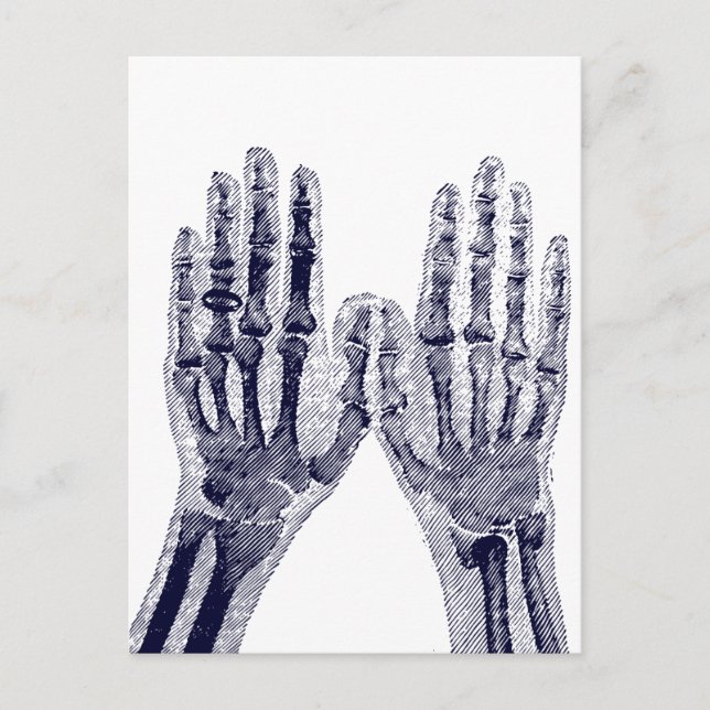 Skeleton Hands Xray Picture drawing Human Anatomy Postcard (Front)