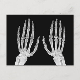 Skeleton Hands Xray Picture Human Anatomy photo Postcard