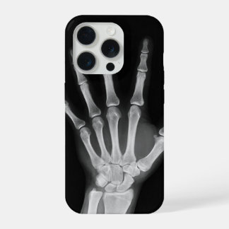 Skeleton iPhone 15 pro cover
