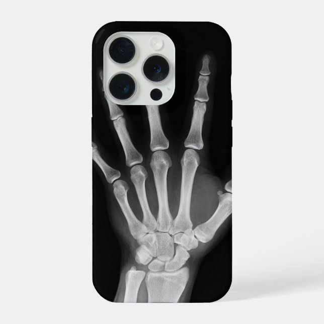 Skeleton iPhone 15 pro cover (Back)