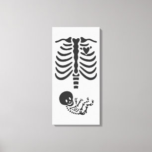 Skeletons Canvas Print